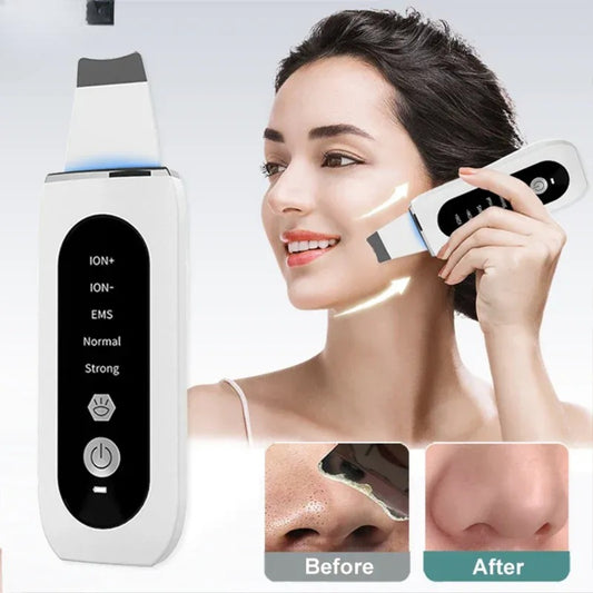 Ultrasonic Skin Scrubber Blackhead Remover